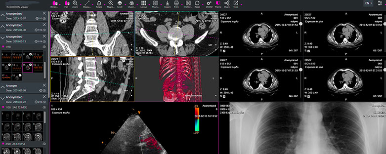 the-dicom-viewer-standard